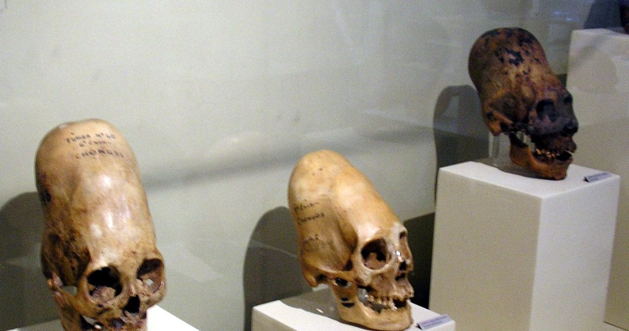 Several human skulls with elongated braincases displayed in a museum case