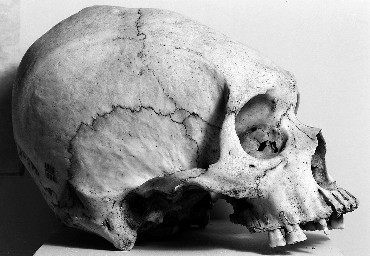 A skull with a markedly lengthened braincase, photographed against a plain ground