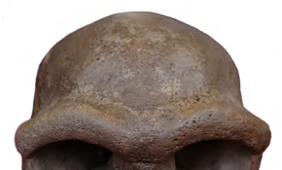 The holotype cranium of the Harbin skull, nicknamed Dragon Man, now genetically confirmed as Denisovan