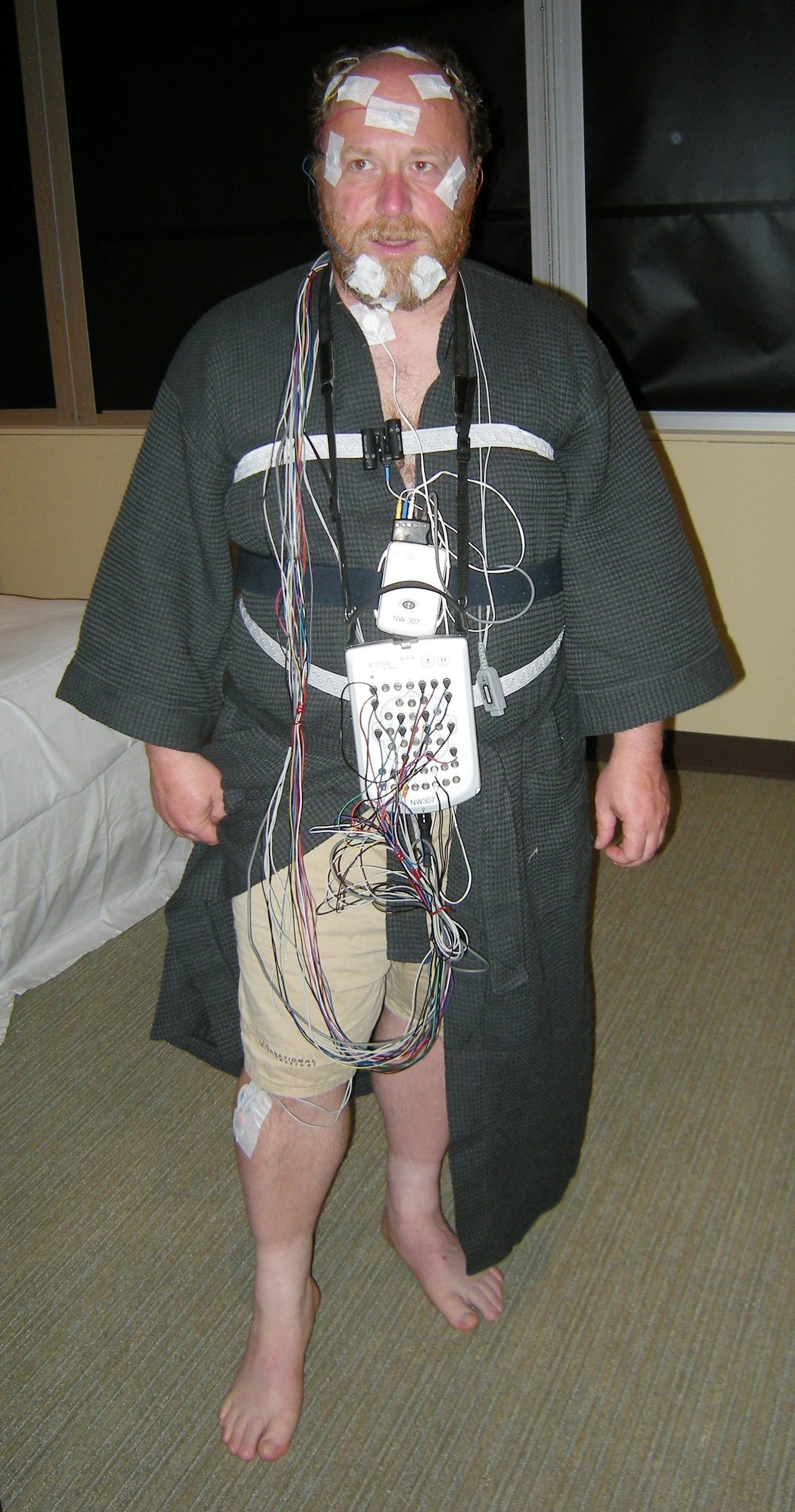A person wired with electrodes for a polysomnography clinical sleep study