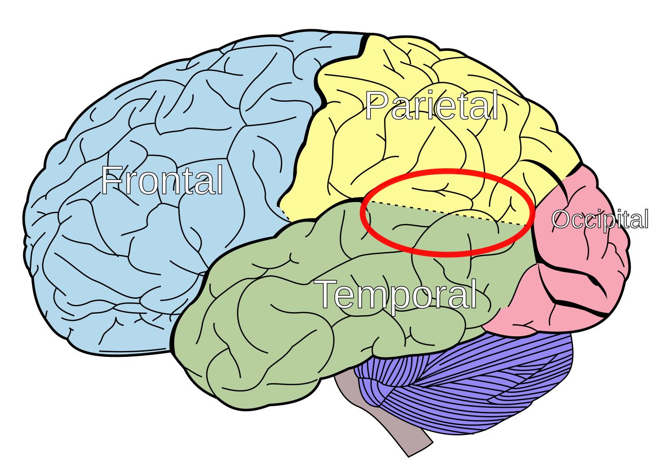 Anatomical diagram of the brain highlighting the temporo-parietal junction